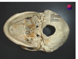Cóndilo
Apófisis estiloides
Apófisis pterigoides
Vómer
Apófisis basilar
Foramen magnum
 