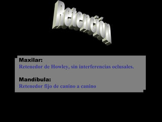 Maxilar:
Retenedor de Howley, sin interferencias oclusales.
Mandíbula:
Retenedor fijo de canino a canino
Maxilar:
Retenedor de Howley, sin interferencias oclusales.
Mandíbula:
Retenedor fijo de canino a canino
 