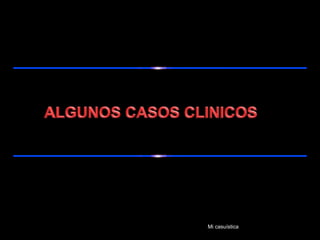 Mi casuística
 