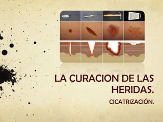 LA CURACION DE LAS
HERIDAS.
CICATRIZACIÓN.

 