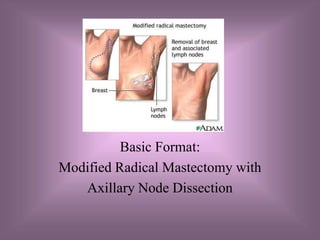 Procedures

          Basic Format:
Modified Radical Mastectomy with
   Axillary Node Dissection
 