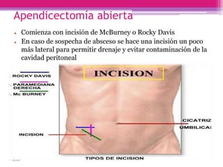 Apendicectomía abierta
 Comienza con incisión de McBurney o Rocky Davis
 En caso de sospecha de absceso se hace una incisión un poco
más lateral para permitir drenaje y evitar contaminación de la
cavidad peritoneal
 