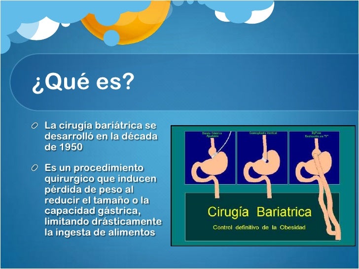 Cirugia bariatrica Cirugia bariatrica
