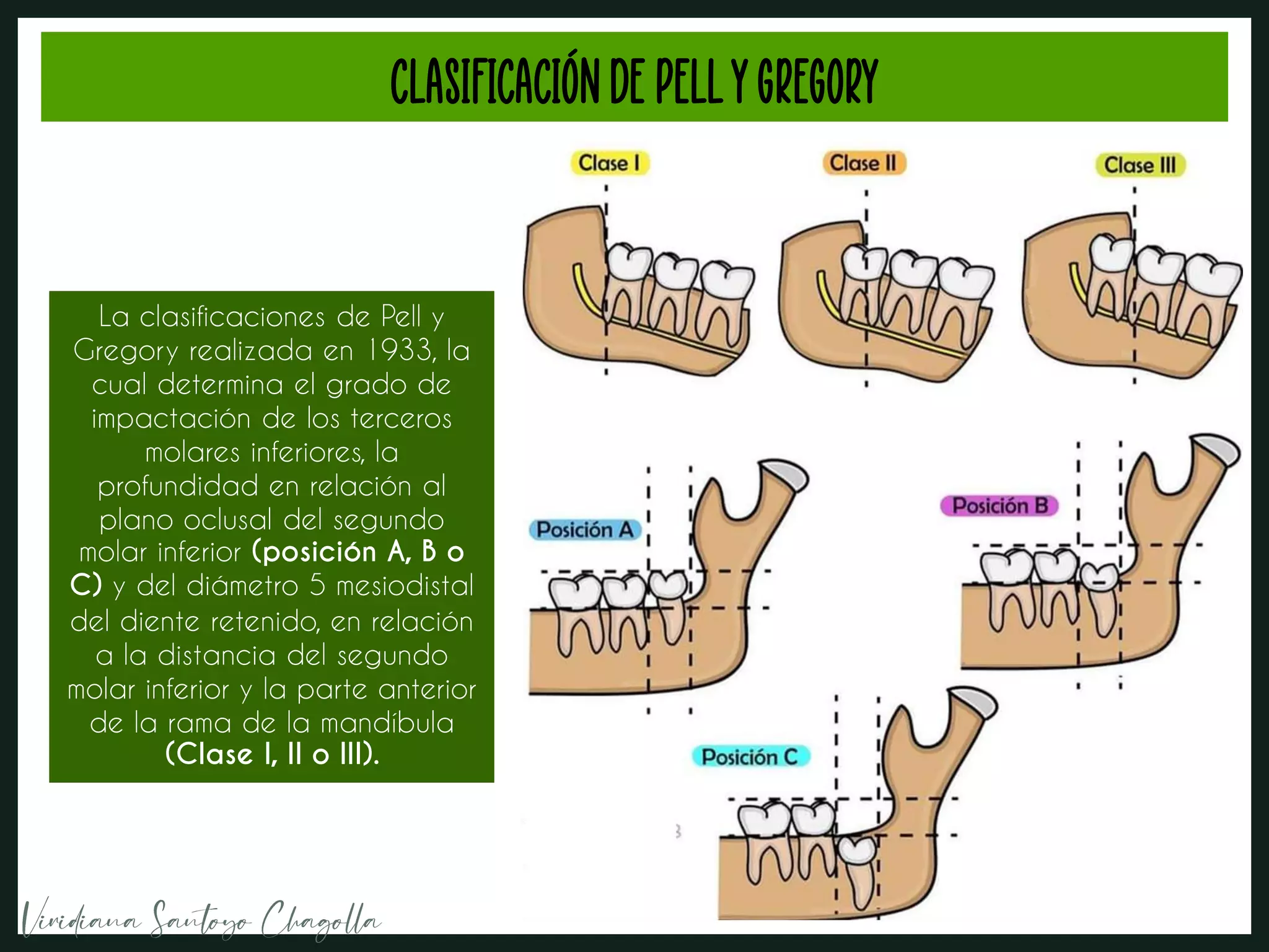 CIRUGIA BUCAL- clasificación de winter pell y gregory.pdf