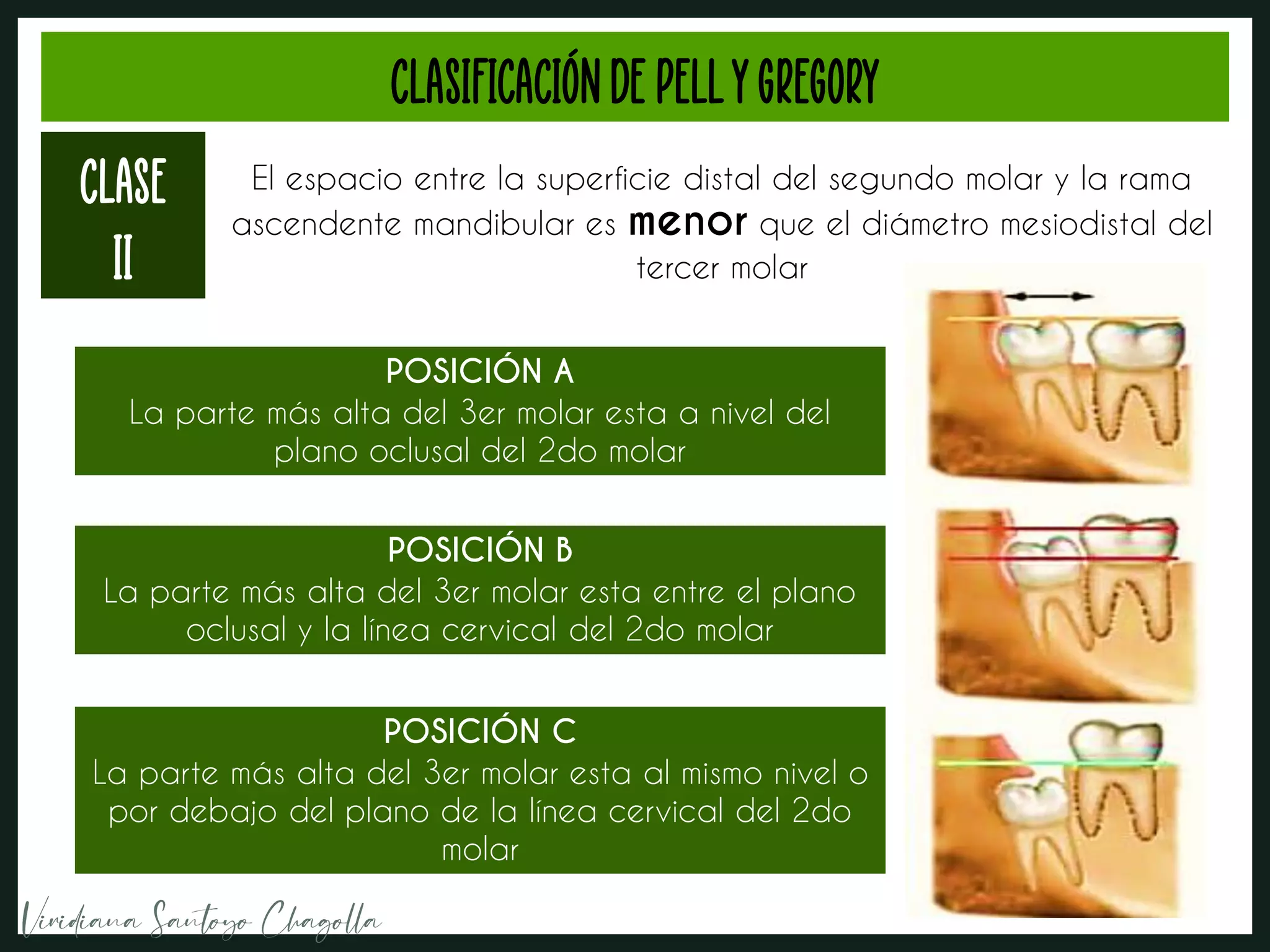 Clasificacion De Winter Y Pell Y Gregory