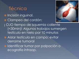  Incisión inguinal.
 Clampeo del cordón:
¡ OJO tiempo de isquemia caliente
(<30min)! Algunos trabajos sumergen
testículo en hielo por 10 minutos
 Aislar testículo en campo: evitar
derrame tumoral
 Identificar tumor por palpación o
ecografía intraop.
 