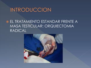  EL TRATAMIENTO ESTANDAR FRENTE A
MASA TESTICULAR: ORQUIECTOMIA
RADICAL
 
