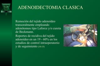 ADENOIDECTOMIA CLASICA

Remoción del tejido adenoideo
transoralmente empleando
adenótomos tipo Laforce y/o cureta
de Beckmann.
Reportes de recidiva del tejido
adenoideo en un 19 - 60% en los
estudios de control intraoperatorio
y de seguimiento (10-15)
 