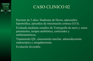 CASO CLINICO 02

Paciente de 3 años: Síndrome de Down, adenoiditis
hipertrófica, episodios de rinosinusitis crónica (UCI).
Evaluada mediante estudios de Tomografía de nariz y senos
paranasales, terapia antibiótica, corticoides y
antihistamínicos.
Tratamiento QX. sinusotomía maxilar, adenoidectomía
endoscópica y amigdalotomía.
Evolución favorable.
 