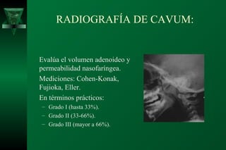 RADIOGRAFÍA DE CAVUM:


Evalúa el volumen adenoideo y
permeabilidad nasofaríngea.
Mediciones: Cohen-Konak,
Fujioka, Eller.
En términos prácticos:
– Grado I (hasta 33%).
– Grado II (33-66%).
– Grado III (mayor a 66%).
 