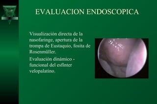 EVALUACION ENDOSCOPICA

Visualización directa de la
nasofaringe, apertura de la
trompa de Eustaquio, fosita de
Rosenmüller.
Evaluación dinámico -
funcional del esfínter
velopalatino.
 
