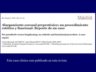 Este caso clinico esta publicado en esta revista.
 
