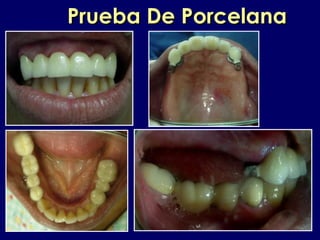 Prueba De PorcelanaPrueba De Porcelana
 