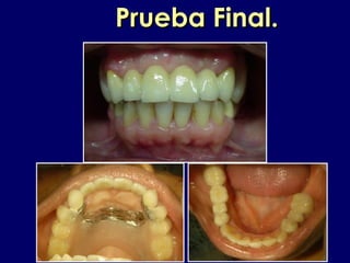 Prueba Final.Prueba Final.
 