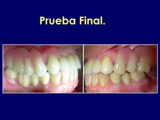 Prueba Final.Prueba Final.
 