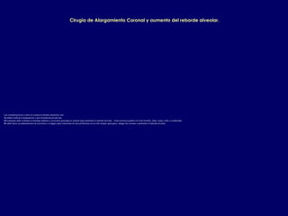 Cirugia de Alargamiento Coronal y aumento del reborde alveolar.
Las consideraciones a tener en cuenta en dientes anteriores son:
1.Se deben realizar la preparacion y provisionalizacion previas.
2.Previamente debe evaluarse el donante palatino y la tecnica quirurgica a realizar para aumentar el reborde alveolar. Estas tecnicas pueden ser la de bolsillo, inlay, onlay, rollo o combinada.
3.Se debe hacer un planeamiento de incisiones y colgajos para solucionar los dos problemas en un solo tiempo quirurgico, alargar las coronas y aumentar el reborde alveolar.
 