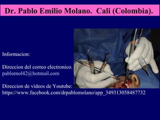 Informacion:
Direccion del correo electronico.
pablomol42@hotmail.com
Direccion de videos de Youtube:
https://www.facebook.com/drpablomolano/app_349313058487732
Dr. Pablo Emilio Molano. Cali (Colombia).
 