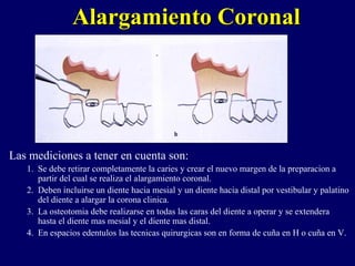 Alargamiento CoronalAlargamiento Coronal
Las mediciones a tener en cuenta son:
1. Se debe retirar completamente la caries y crear el nuevo margen de la preparacion a
partir del cual se realiza el alargamiento coronal.
2. Deben incluirse un diente hacia mesial y un diente hacia distal por vestibular y palatino
del diente a alargar la corona clinica.
3. La osteotomia debe realizarse en todas las caras del diente a operar y se extendera
hasta el diente mas mesial y el diente mas distal.
4. En espacios edentulos las tecnicas quirurgicas son en forma de cuña en H o cuña en V.
 