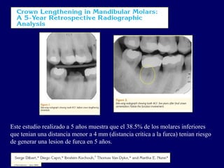 Este estudio realizado a 5 años muestra que el 38.5% de los molares inferiores
que tenian una distancia menor a 4 mm (distancia critica a la furca) tenian riesgo
de generar una lesion de furca en 5 años.
 