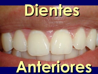 DientesDientes
AnterioresAnteriores
 