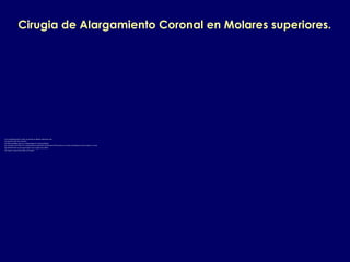 Cirugia de Alargamiento Coronal en Molares superiores.
Las consideraciones a tener en cuenta en dientes anteriores son:
1.La posicion del seno maxilar.
2.La altura palatina para no comprometer la arteria palatina.
3.La cercania a las furcas lo cual produciria aparicion de lesiones de furcacion si se tiene una distancia critica menor a 4 mm.
4.La dificultad de acceso quirurgico en la region mas distal.
5.El espacio interoclusal debe ser amplio.
 