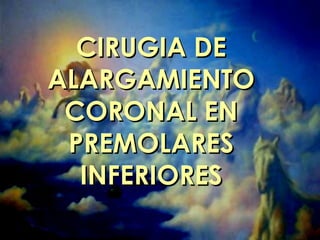CIRUGIA DECIRUGIA DE
ALARGAMIENTOALARGAMIENTO
CORONAL ENCORONAL EN
PREMOLARESPREMOLARES
INFERIORESINFERIORES
 