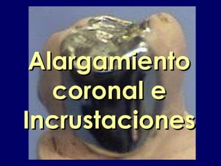 AlargamientoAlargamiento
coronal ecoronal e
IncrustacionesIncrustaciones
 