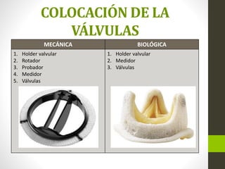 COLOCACIÓN DE LA
VÁLVULAS
MECÁNICA BIOLÓGICA
1. Holder valvular
2. Rotador
3. Probador
4. Medidor
5. Válvulas
1. Holder valvular
2. Medidor
3. Válvulas
 