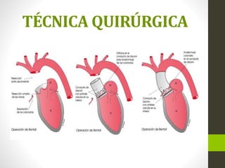 TÉCNICA QUIRÚRGICA
 