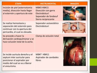 ETAPA INSTRUMENTAL IMAGEN
Incisión de piel (esternotomía
media), disección hasta llegar
al esternón y apertura de este
MB#3 HB#15
Disección con garra
Electrobisturí
Separador de farabeuf
Sierra reciprocante
Se realiza hemostasia y
separación del esternón para
continuar con la apertura del
pericardio, el cual es elevado.
Separador autoestático
Electrobisturí
Se procede a hacer la
derivación cardiopulmonar y se
hace oclusión total de la aorta.
Clamp de oclusión total
Se incide aurícula derecha y el
septum inter auricular para
posicionar el aspirador por
medio del cual se va a liberar
el aneurisma.
MB#7 HB#11
Aspirador de cavidades
libres
 