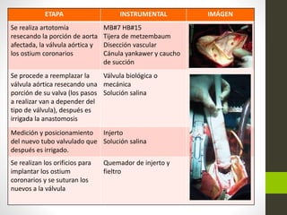 ETAPA INSTRUMENTAL IMÁGEN
Se realiza artotomía
resecando la porción de aorta
afectada, la válvula aórtica y
los ostium coronarios
MB#7 HB#15
Tijera de metzembaum
Disección vascular
Cánula yankawer y caucho
de succión
Se procede a reemplazar la
válvula aórtica resecando una
porción de su valva (los pasos
a realizar van a depender del
tipo de válvula), después es
irrigada la anastomosis
Válvula biológica o
mecánica
Solución salina
Medición y posicionamiento
del nuevo tubo valvulado que
después es irrigado.
Injerto
Solución salina
Se realizan los orificios para
implantar los ostium
coronarios y se suturan los
nuevos a la válvula
Quemador de injerto y
fieltro
 