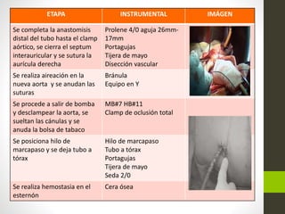 ETAPA INSTRUMENTAL IMÁGEN
Se completa la anastomisis
distal del tubo hasta el clamp
aórtico, se cierra el septum
interauricular y se sutura la
aurícula derecha
Prolene 4/0 aguja 26mm-
17mm
Portagujas
Tijera de mayo
Disección vascular
Se realiza aireación en la
nueva aorta y se anudan las
suturas
Bránula
Equipo en Y
Se procede a salir de bomba
y desclampear la aorta, se
sueltan las cánulas y se
anuda la bolsa de tabaco
MB#7 HB#11
Clamp de oclusión total
Se posiciona hilo de
marcapaso y se deja tubo a
tórax
Hilo de marcapaso
Tubo a tórax
Portagujas
Tijera de mayo
Seda 2/0
Se realiza hemostasia en el
esternón
Cera ósea
 