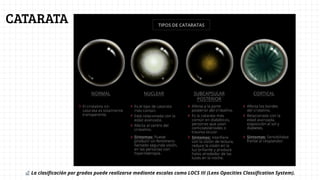 CIRUGIA DE CATARATA : EVALUACION Y MANEJO CLINICO | PDF