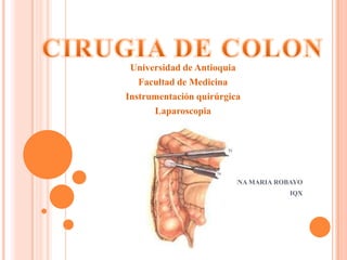 CIRUGIA DE COLON Universidad de Antioquia Facultad de Medicina Instrumentación quirúrgica Laparoscopia LINA MARIA ROBAYO IQX 