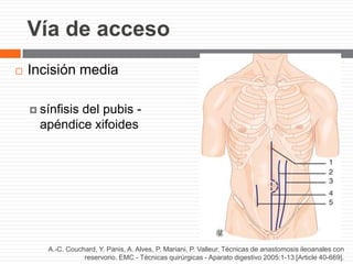 Vía de acceso
 Incisión media
 sínfisis del pubis -
apéndice xifoides
A.-C. Couchard, Y. Panis, A. Alves, P. Mariani, P. Valleur. Técnicas de anastomosis ileoanales con
reservorio. EMC - Técnicas quirúrgicas - Aparato digestivo 2005:1-13 [Article 40-669].
 