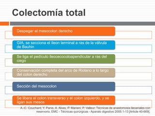 Colectomía total
Despegar el mesocolon derecho
GIA, se secciona el íleon terminal a ras de la válvula
de Bauhin
Se liga el pedículo ileocecocoloapendicular a ras del
ciego
Conservación completa del arco de Riolano a lo largo
del colon derecho
Sección del mesocolon
Se libera el colon transverso y el colon izquierdo, y se
ligan sus mesos
A.-C. Couchard, Y. Panis, A. Alves, P. Mariani, P. Valleur. Técnicas de anastomosis ileoanales con
reservorio. EMC - Técnicas quirúrgicas - Aparato digestivo 2005:1-13 [Article 40-669].
 