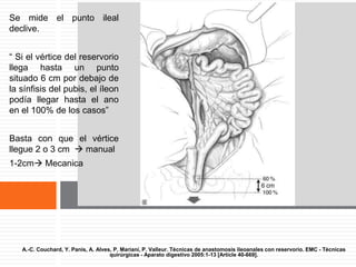 Maniobra de Smith
Se mide el punto ileal
declive.
“ Si el vértice del reservorio
llega hasta un punto
situado 6 cm por debajo de
la sínfisis del pubis, el íleon
podía llegar hasta el ano
en el 100% de los casos”
Basta con que el vértice
llegue 2 o 3 cm  manual
1-2cm Mecanica
A.-C. Couchard, Y. Panis, A. Alves, P. Mariani, P. Valleur. Técnicas de anastomosis ileoanales con reservorio. EMC - Técnicas
quirúrgicas - Aparato digestivo 2005:1-13 [Article 40-669].
 