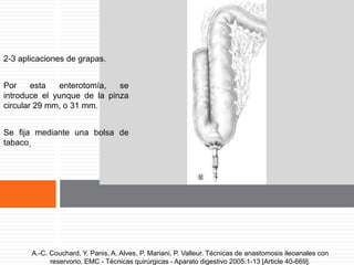 Vástago del yunque situado en el
vértice del reservorio.2-3 aplicaciones de grapas.
Por esta enterotomía, se
introduce el yunque de la pinza
circular 29 mm, o 31 mm.
Se fija mediante una bolsa de
tabaco.
A.-C. Couchard, Y. Panis, A. Alves, P. Mariani, P. Valleur. Técnicas de anastomosis ileoanales con
reservorio. EMC - Técnicas quirúrgicas - Aparato digestivo 2005:1-13 [Article 40-669].
 