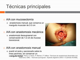 Técnicas principales
 AIA con mucosectomía
 anastomosis manual, que conserva un
manguito muscular de 2-3 cm
 AIA con anastomosis mecánica
 anastomosis ileosupraanal con
conservación de 1-2 cm de mucosa
transicional.
 AIA con anastomosis manual
 evertir el recto y seccionarlo sobre la
línea pectínea, sin conservar un
manguito rectalA.-C. Couchard, Y. Panis, A. Alves, P. Mariani, P. Valleur. Técnicas de anastomosis ileoanales con
reservorio. EMC - Técnicas quirúrgicas - Aparato digestivo 2005:1-13 [Article 40-669].
 