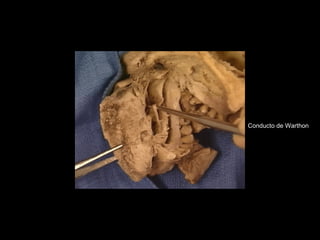 Conducto de Warthon
 