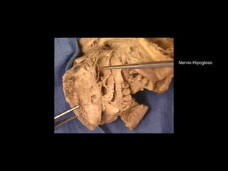 Nervio Hipogloso
 