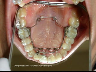 Ortognapedia: Dra. Luz Alicia Parra Enríquez
 
