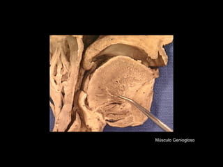 Músculo Geniogloso
 