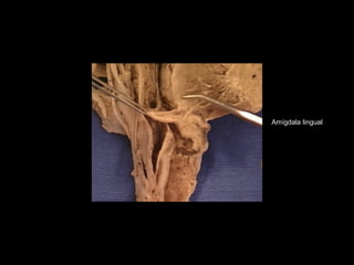 Amígdala lingual
 