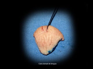Cara dorsal de lengua
 