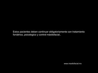 Estos pacientes deben continuar obligatoriamente con tratamiento
foniátrico, psicologico y control máxilofacial..
www.maxilofacial.mx
 