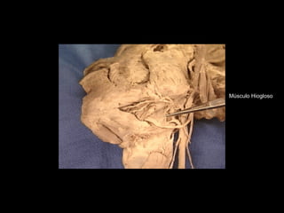 Músculo Hiogloso
 