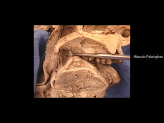 Músculo Palatogloso
 
