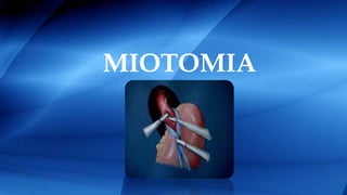 MIOTOMIA
 