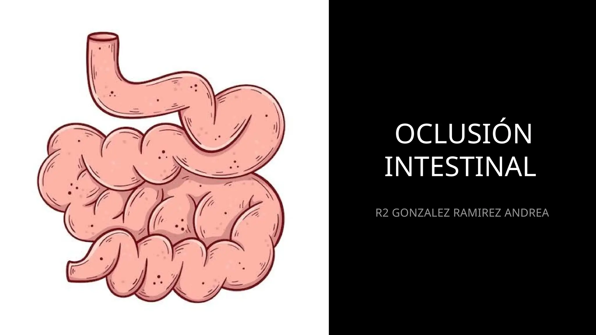 Cirugía de tracto digestivo bbbbbbbbbbb | PPTX | Digestive Disorders ...
